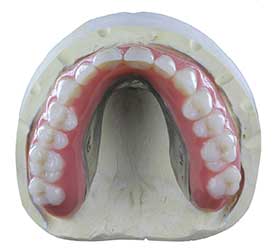 Visser Arabisch dek hybride-bovenprothese-klein - Labo De Witte - partner van de tandarts